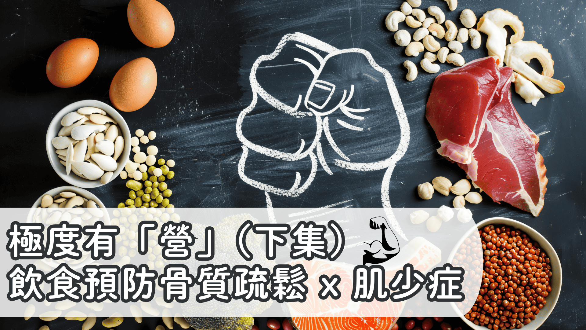 极度有“营”--饮食预防骨质疏松 x 肌少症（下集）