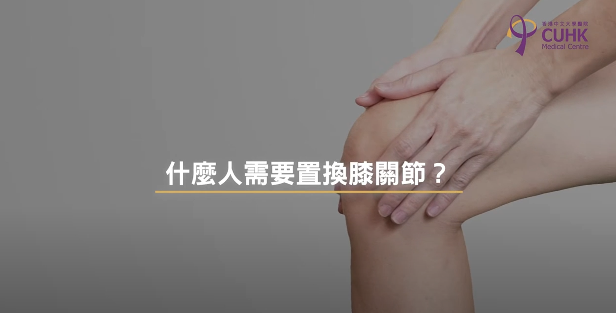 [医生讲场] 人工膝关节手术 (何其威医生)